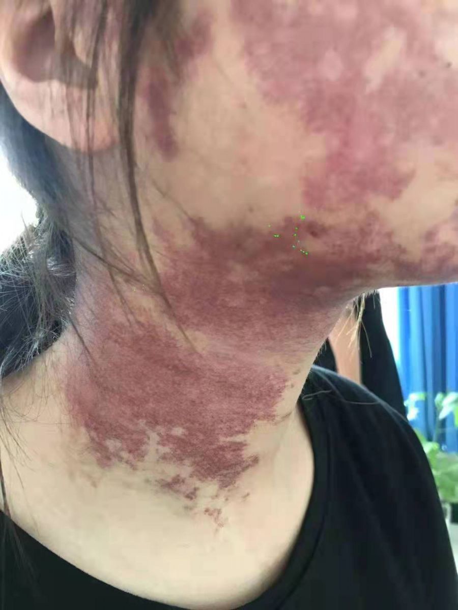 戳我试试